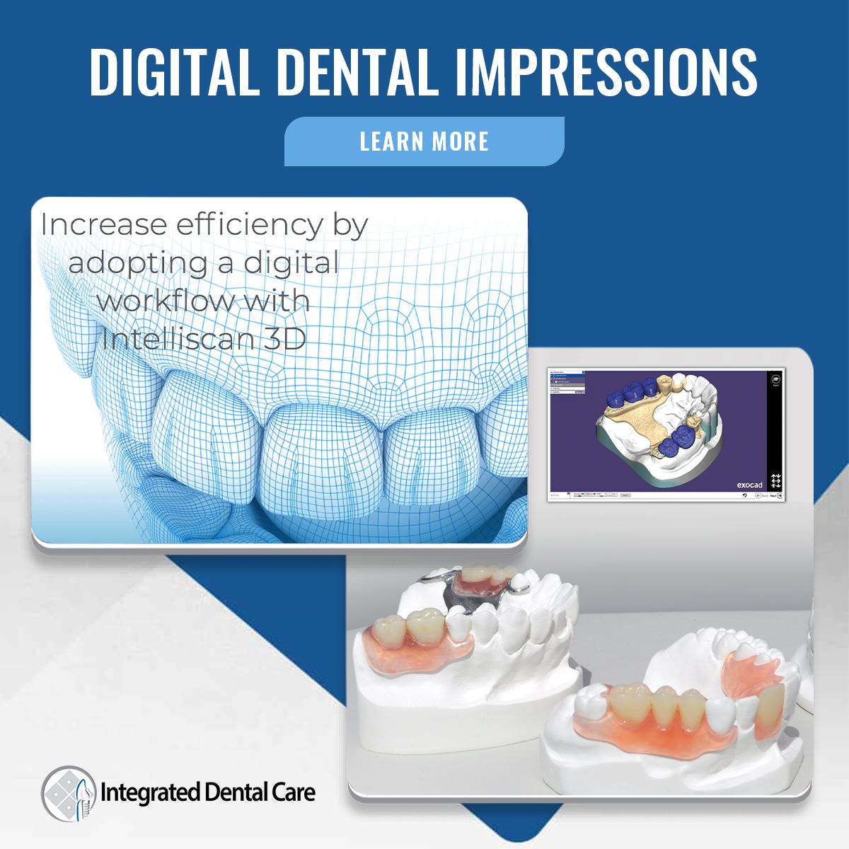 3D Intraoral Scanner