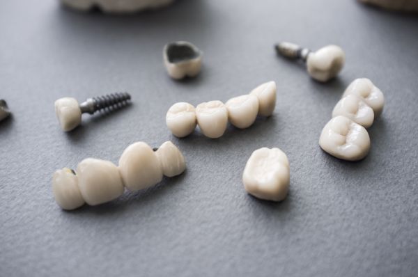 dental crowns and implants
