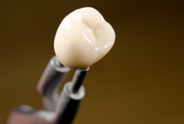 Dental implant