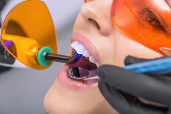 Woman getting her teeth whitened 