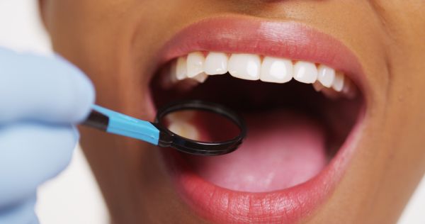 Woman receiving a dental exam