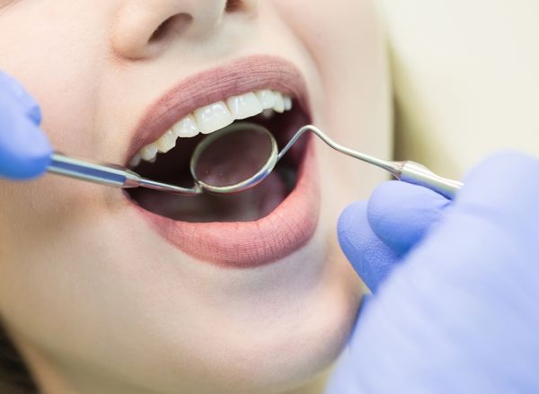 Woman with dental instruments in her mouth