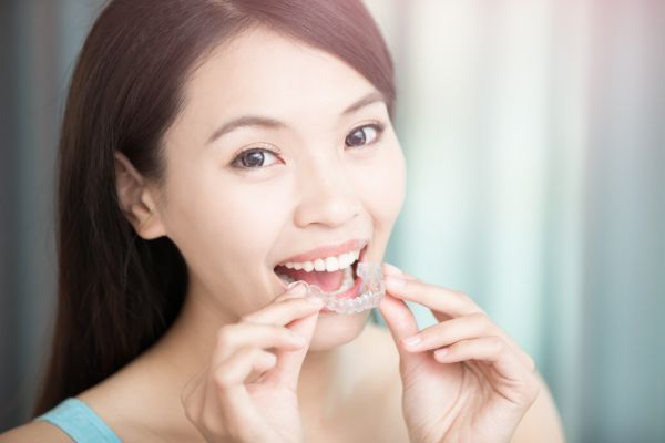 Woman putting in clear aligners